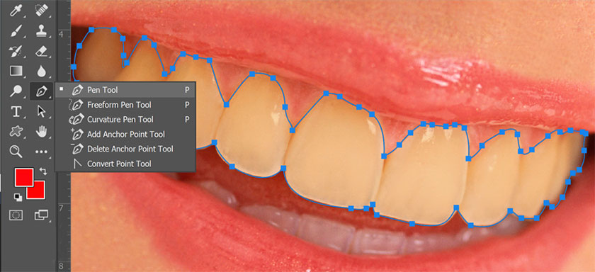 Tạo vùng chọn ở xung quanh phần răng của người mẫu