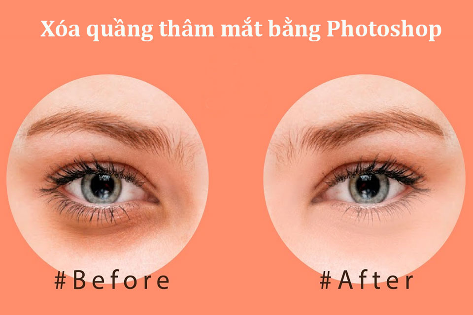 2 Cách xóa quầng thâm mắt trong Photoshop