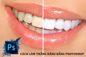 7+ Cách Làm trắng răng trong Photoshop