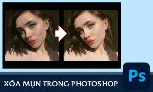4 cách xóa mụn trong photoshop CỰC ĐƠN GIẢN